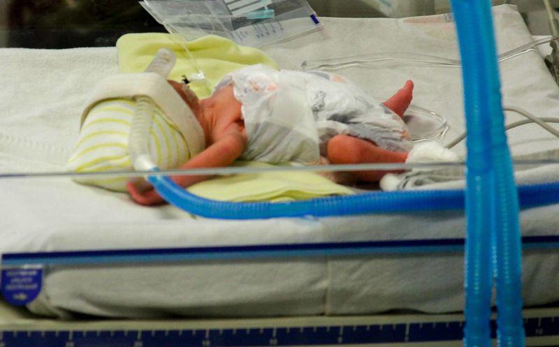 Aumentan casos de nacimientos prematuros en Puebla: IMSS