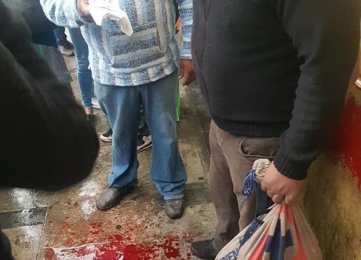 Recibe machetazo en la cabeza en intento de asalto en Teziutlán