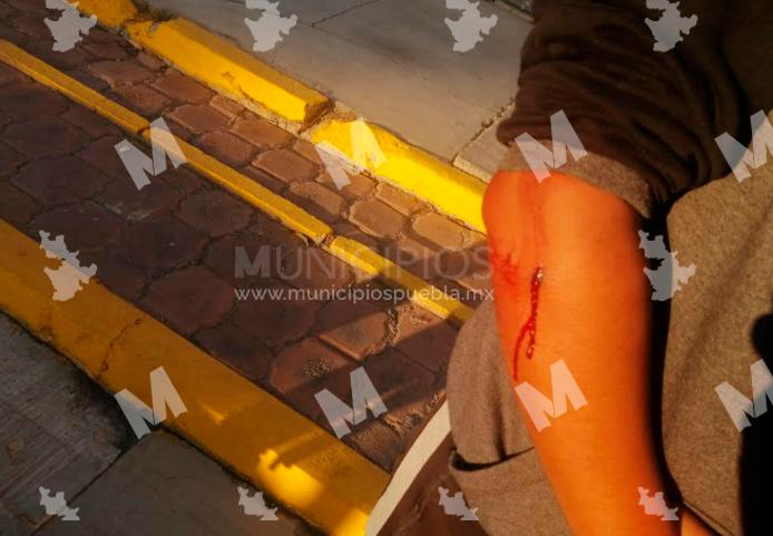 Balean a estudiante de la Universidad Tecnológica de Huejotzingo