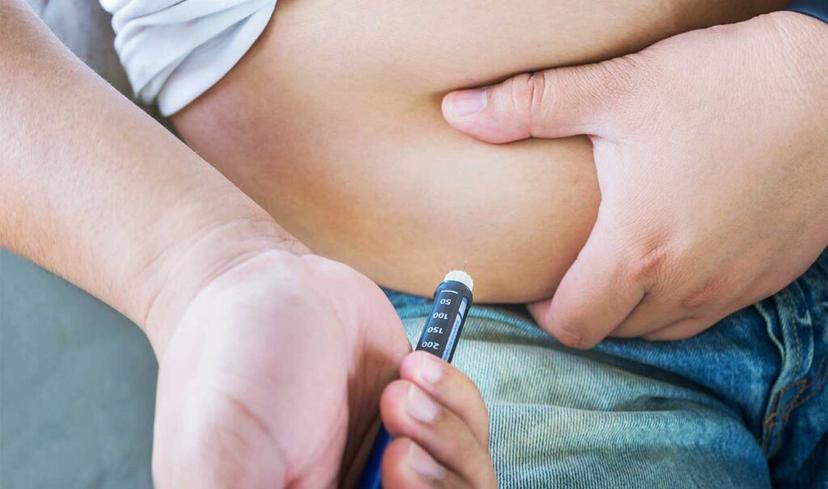 Cetoacidosis diabética es una complicación grave de la diabetes tipo 1
