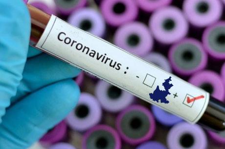 Dar positivo de Covid no significa que el virus siga vivo: estudio