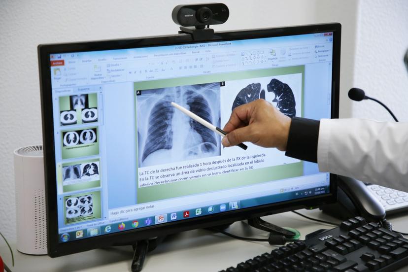 Atiende IMSS daño pulmonar y dificultad respiratoria causadas por covid