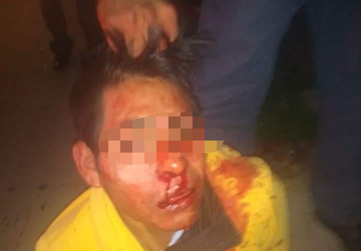 Golpean y casi linchan a ladrón en Huejotzingo