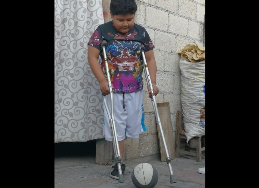 Niño atlixquense hace vaquita para comprar prótesis 