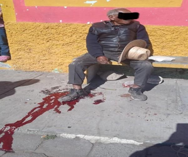 Canino muerde a persona de la tercera edad en Atlixco