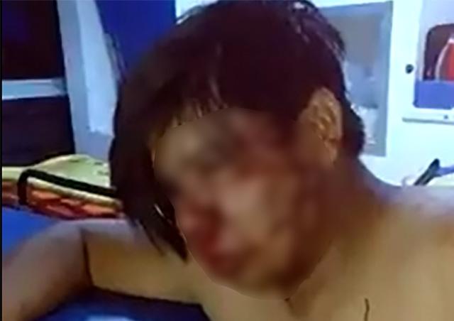 VIDEO Acusan a edil auxiliar de La Galarza en Izúcar de golpear a jóvenes