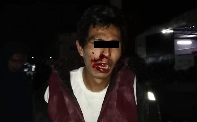 Quiso robar bici a abuelito y termina golpeado por vecinos en Xochimehuacan