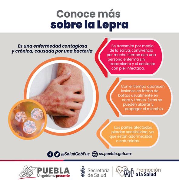 Detectan casos de lepra en la Mixteca poblana