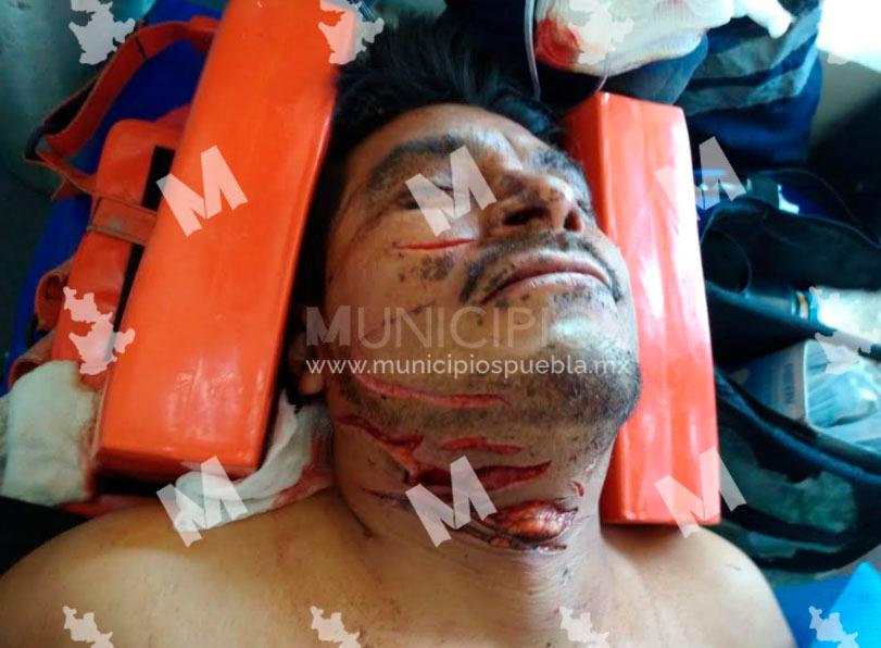 Navajean en cara y cuello a sujeto y aun así sobrevive en Huejotzingo