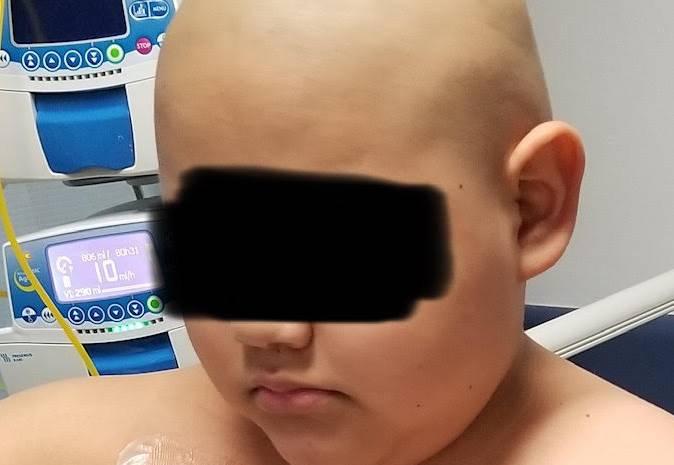 Niño atlixquense requiere ayuda para salvar la vida