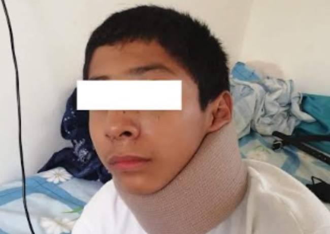 Estudiante de secundaria en Coxcatlán recibe golpiza de 3 de sus compañeros