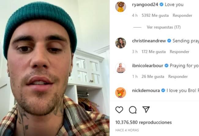 VIDEO Justin Bieber suspende conciertos por parálisis facial