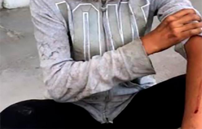 Pitbull ataca a una mujer y a paramédico en Izúcar  
