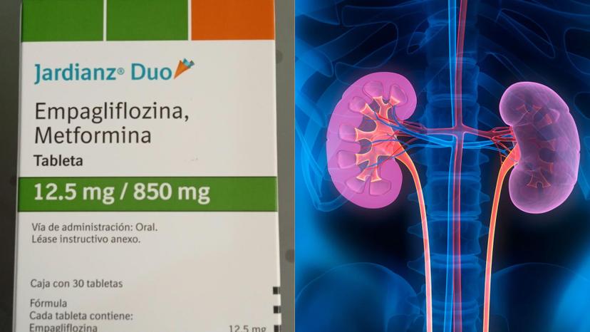 Cofepris aprueba innovador tratamiento para enfermedades renales crónicas 