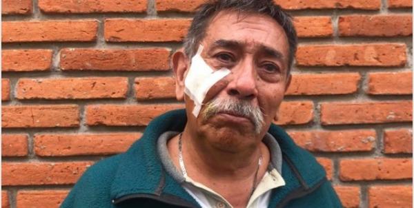 Anciano recibe ayuda económica y delincuentes lo hurtan en Atlixco