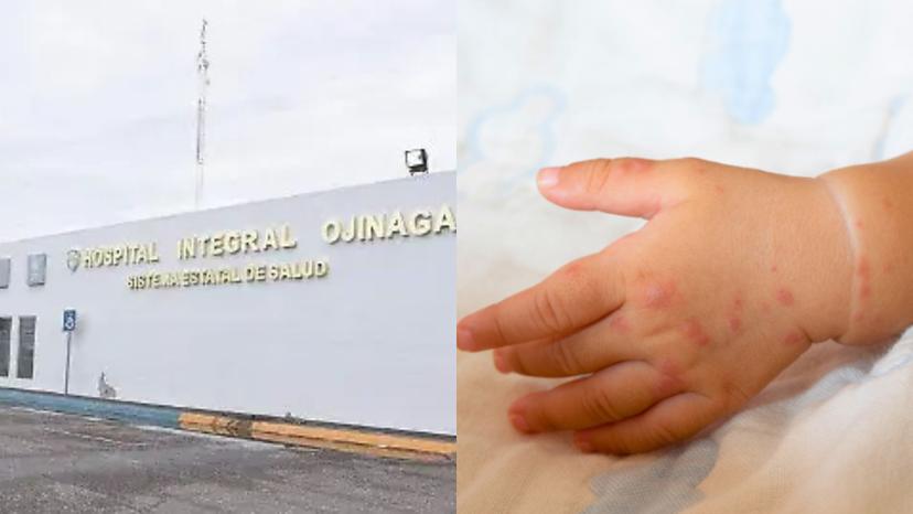Por brotes de sarampión en la frontera, muere niña rarámuri en Chihuahua