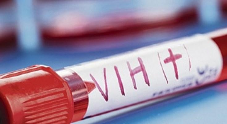 Existen 11 mil nuevos contagios de VIH cada año en México