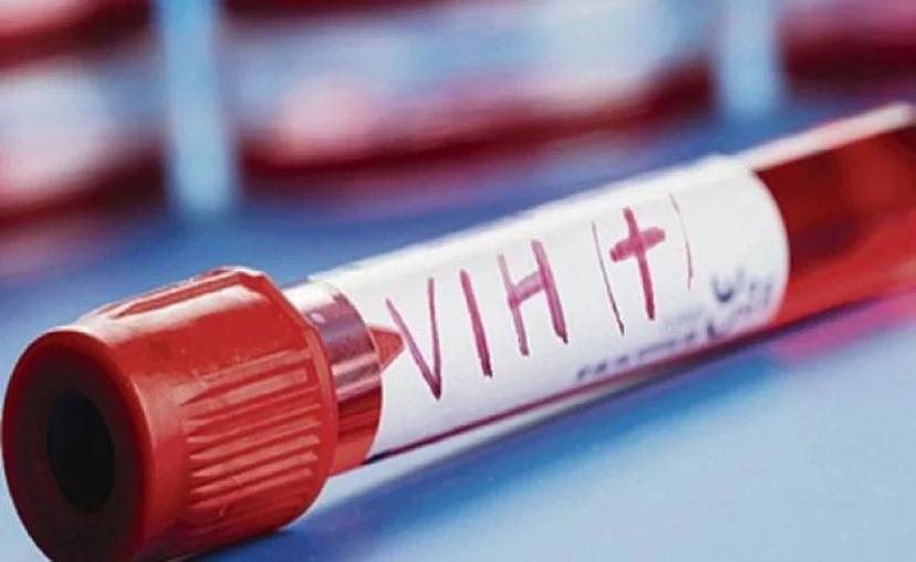 Sexo sin protección con portadores de VIH, nuevo reto viral