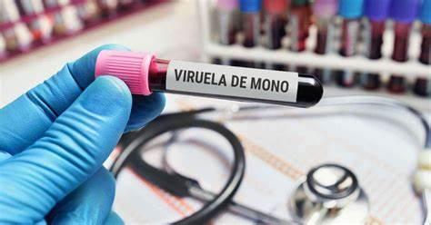 Viruela del mono ya no será enfermedad endémica: OMS