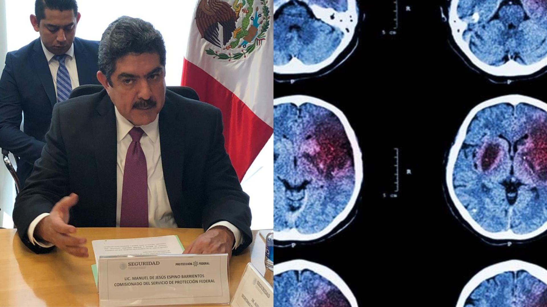 Diputado sufre un derrame cerebral
