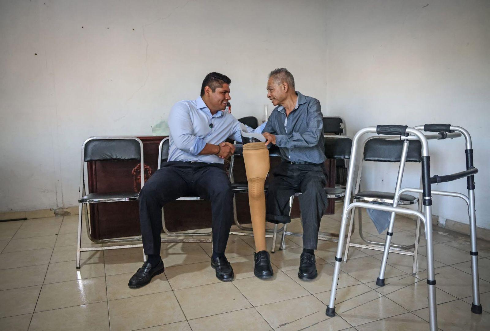 protesis-omar muñoz