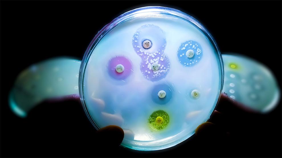 Se calcula que para 2050 morirán 10 millones de personas cada año por infecciones resistentes a los antibióticos.