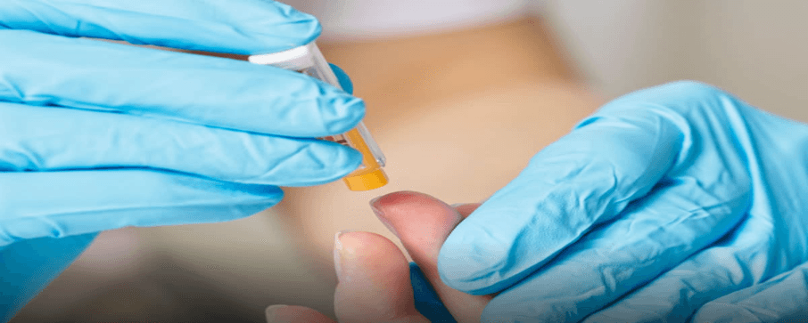 Hospital Juárez de México mantiene campaña permanente de Hepatitis C.